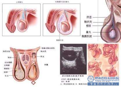 不射精要如何治疗