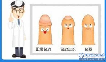 嵊州医院包皮_总共下来多少钱?去那家医院好？